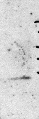 Western Blot: Histone H4 [Trimethyl Lys20] Antibody [NBP2-59259]